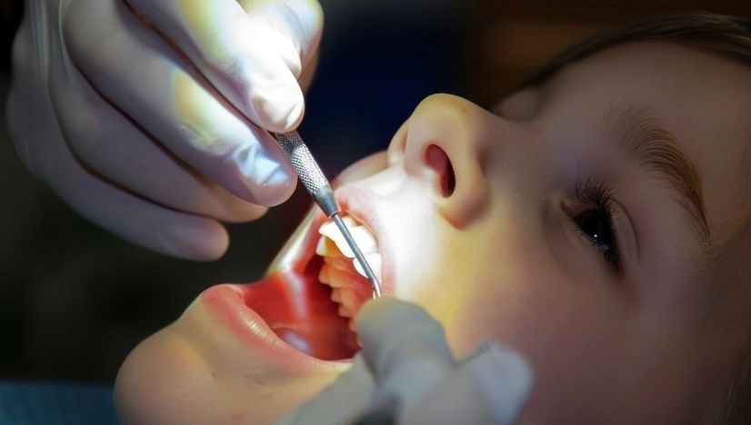 Fluoride Treatments For Kids