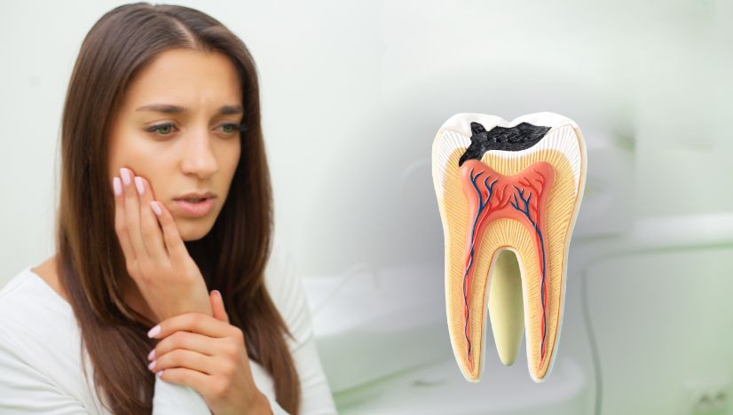 Natural Smile with  Tooth-Colored Fillings 